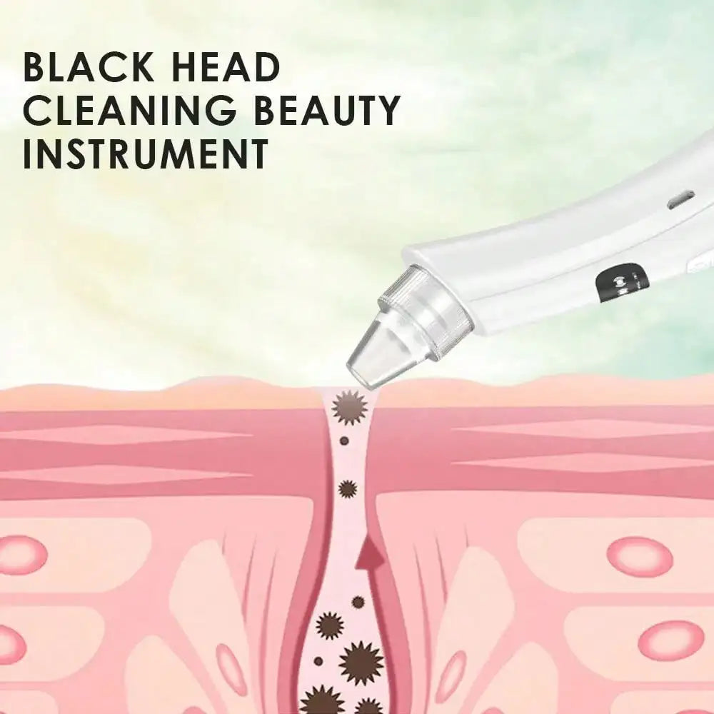 Dead Skin Remover Face Vacuum Blackhead Removal Machine